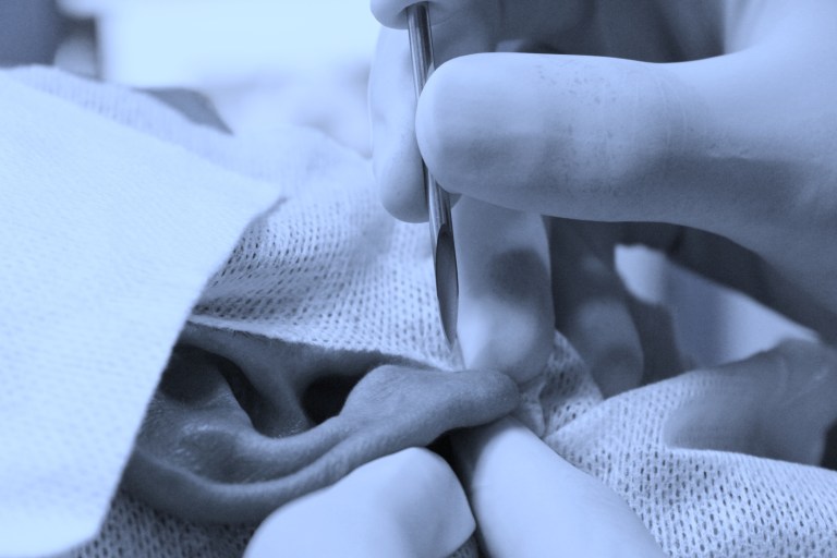 Foto dimostrativa di una perforazione a 4 mm